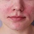 Применение по проблемам кожи